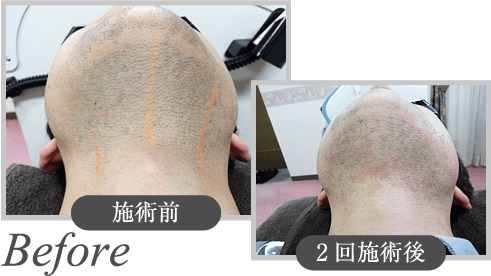 Before ̿